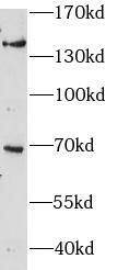 ZBTB11 Antibody - BSA Free
