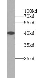 ZADH2 Antibody - BSA Free