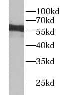 YTHDF3 Antibody - BSA Free