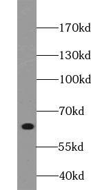 YTHDF2 Antibody - BSA Free