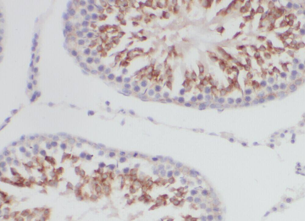 YTHDF2 Antibody - BSA Free