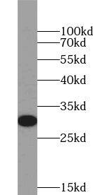 YIPF5 Antibody - BSA Free