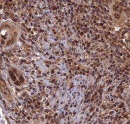 YEATS2 Antibody - BSA Free