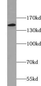 YEATS2 Antibody - BSA Free