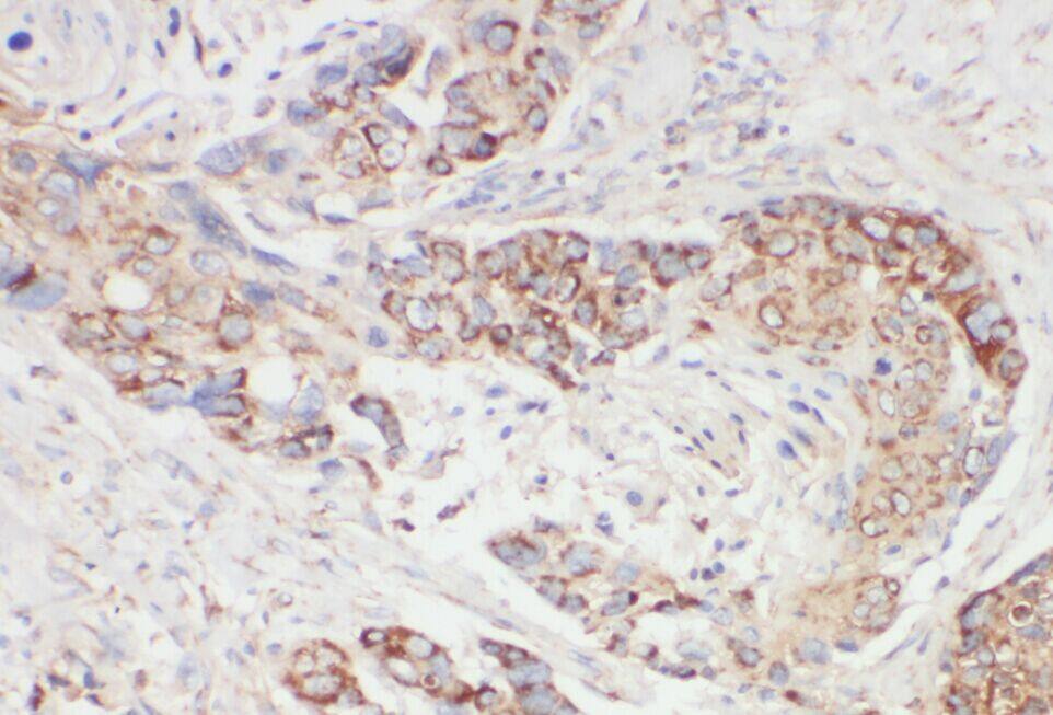 XPNPEP3 Antibody - BSA Free