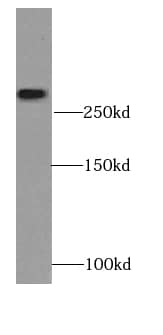 CMYA3 Antibody - BSA Free