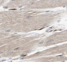 CMYA3 Antibody - BSA Free