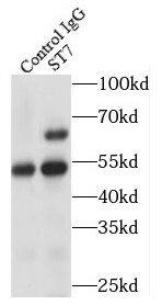 Suppression of Tumorigenicity 7 Antibody - BSA Free