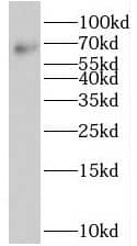 Suppression of Tumorigenicity 7 Antibody - BSA Free
