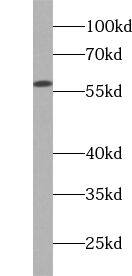 WSB1 Antibody - BSA Free