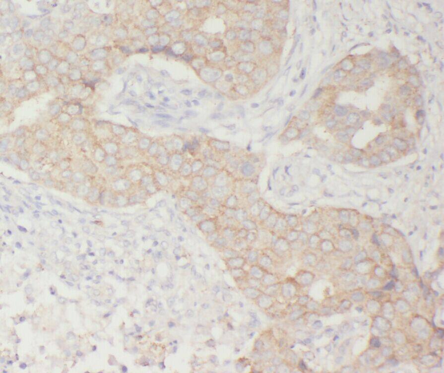 WSB1 Antibody - BSA Free