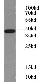 WDR92 Antibody - BSA Free