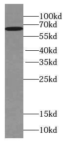 WDR81 Antibody - BSA Free