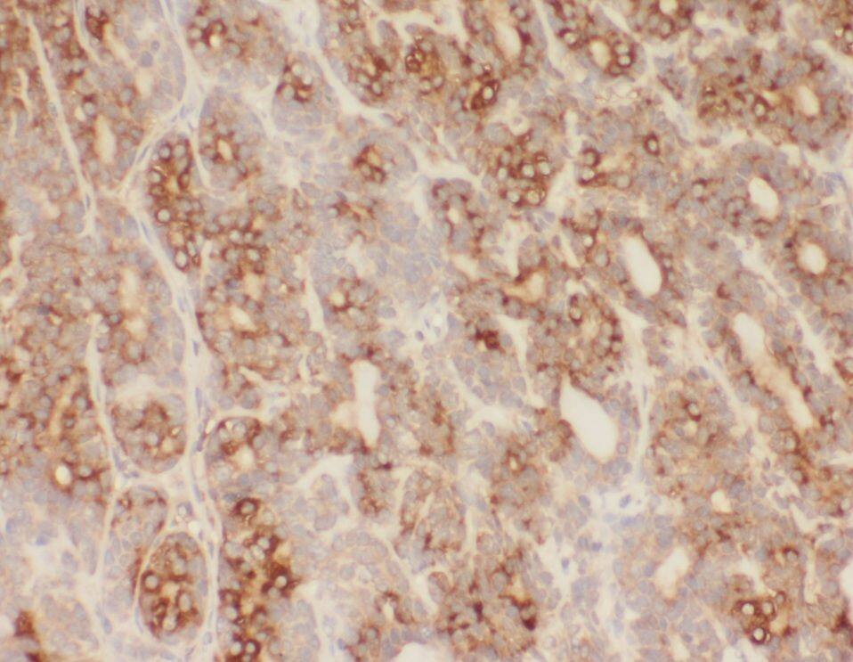 WDR7 Antibody - BSA Free