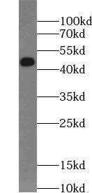DCAF4L2 Antibody - BSA Free