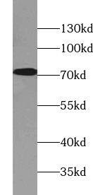 WDR19 Antibody - BSA Free