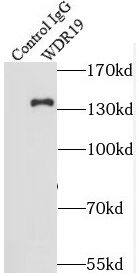 WDR19 Antibody - BSA Free