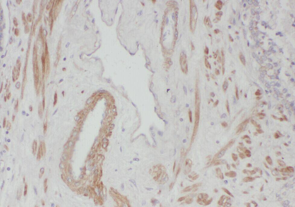 WDR19 Antibody - BSA Free