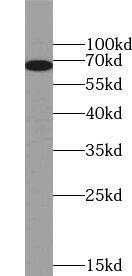 WBSCR17 Antibody - BSA Free