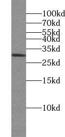 VTI1A Antibody - BSA Free