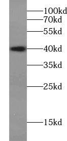 VSTM1 Antibody - BSA Free
