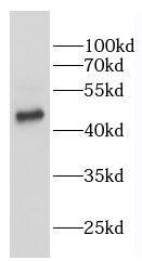 VRK2 Antibody - BSA Free