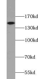 VPS8 Antibody - BSA Free