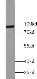 VPS53 Antibody - BSA Free