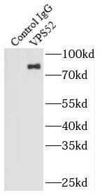 VPS52 Antibody - BSA Free
