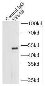 VPS4B Antibody - BSA Free