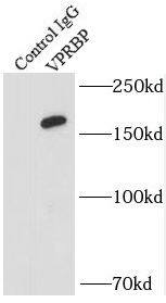 VprBP Antibody - BSA Free