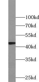 VN1R4 Antibody - BSA Free