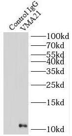 VMA21 Antibody - BSA Free