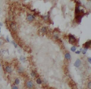 VMA21 Antibody - BSA Free