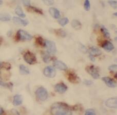 VILIP3 Antibody - BSA Free