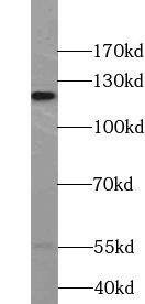 VEZT Antibody - BSA Free