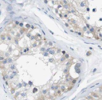 VDAC3 Antibody - BSA Free