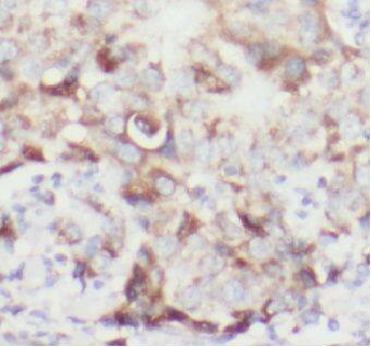 VCIP135/VCPIP1 Antibody - BSA Free