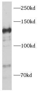VCIP135/VCPIP1 Antibody - BSA Free