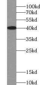 VASH2 Antibody - BSA Free
