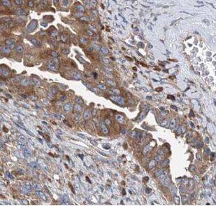 VARS2 Antibody - BSA Free