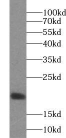 VAMP4 Antibody - BSA Free