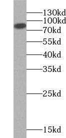 VAC14 Antibody - BSA Free