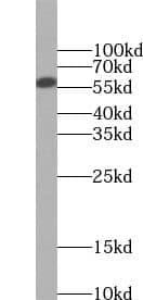 UTP15 Antibody - BSA Free