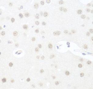 UTP14A Antibody - BSA Free