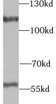 UTP14A Antibody - BSA Free