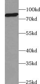 USP35 Antibody - BSA Free