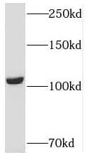 USP33 Antibody - BSA Free