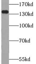 USP25 Antibody - BSA Free