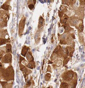 URM1 Antibody - BSA Free